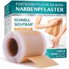 Narbenpflaster von Arlun