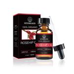 Mindbreaker Hagebuttenkernöl